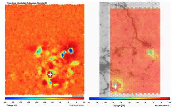 催眠療法と脳科学3